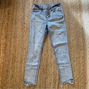 wild fable | High-Rise Acid Wash Button-Fly Jeans | 2